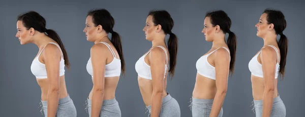 Posture - Osteopathic Techniques